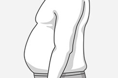 Very prominent