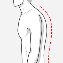 Rounded upper back